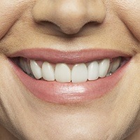 Closeup of healthy smile