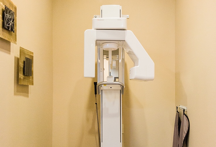 3D cone beam scanner