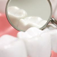 Closeup of teeth with dental sealants