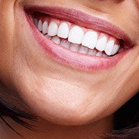 Closeup of smile with healthy teeth and gums