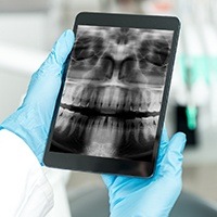 Dental x-rays on tablet computer