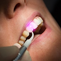 Patient receiving treatment with soft tissue laser